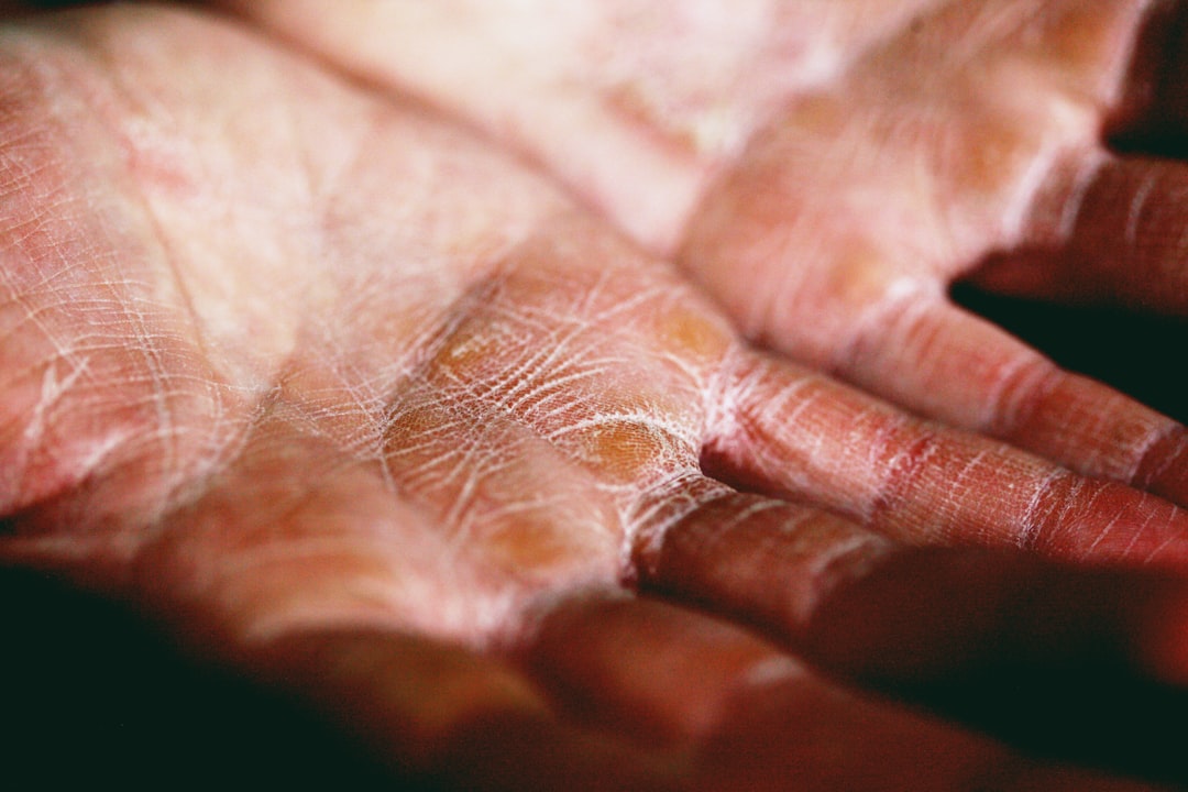 Photo wrinkles, coverage